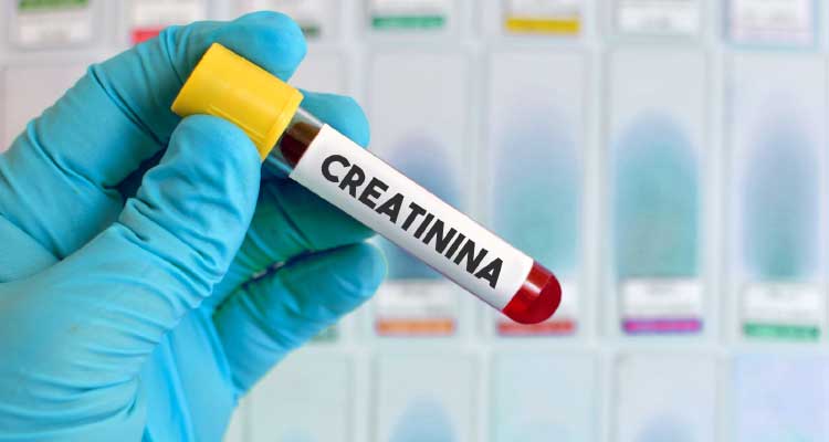 creatinemia